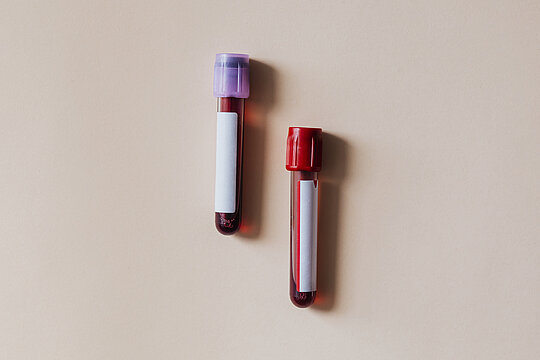 Blood test tubes on a beige background